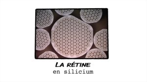 La rétine en silicium